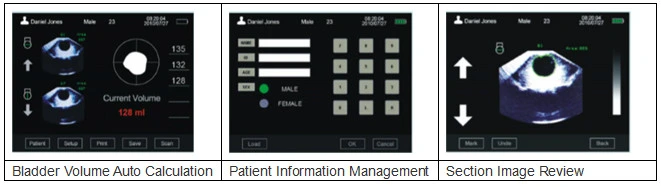 Portable Bladder Scanner (MD-6000)