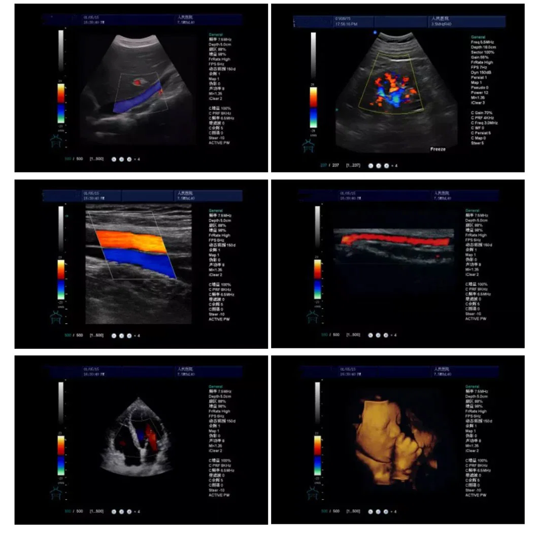 Medical Ultrasonic Instrument 4D Digital Color Doppler Trolley Ultrasound Scanner