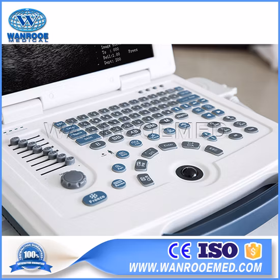 Escáner ultrasónico portátil del ultrasonido del equipo de diagnóstico de Digitaces